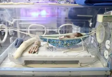 Rede em incubadora é afago para bebês prematuros nas dores do tratamento